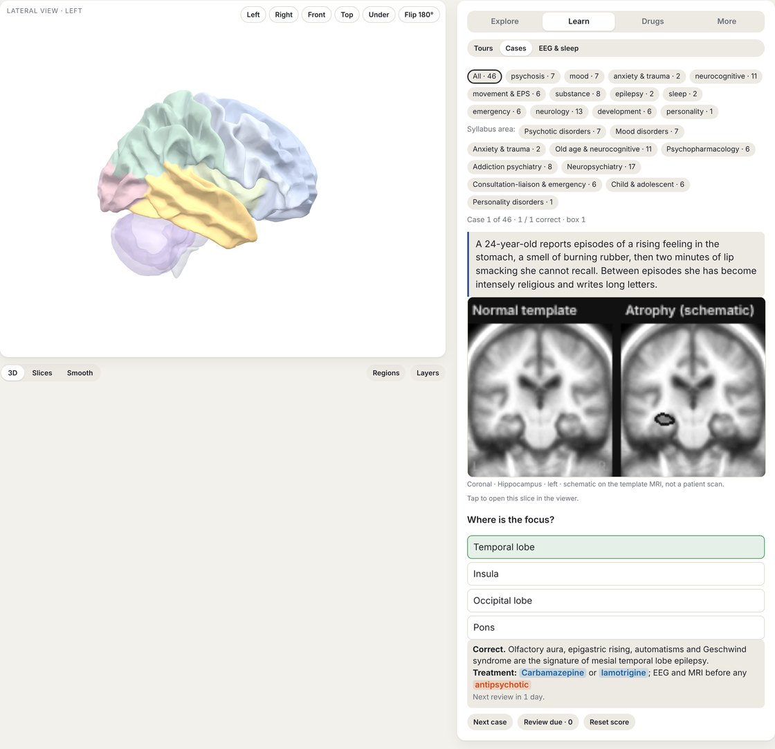 Cases on the scan